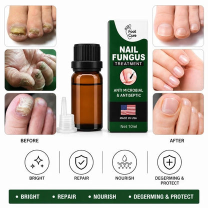 Fast nail repair serum for fingernails and toenails