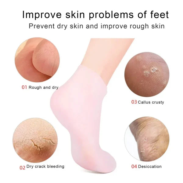 Product advertisement showing a foot with pink socks and images of dry, rough, callus, and cracked skin.