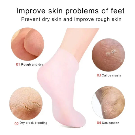 Product advertisement showing a foot with pink socks and images of dry, rough, callus, and cracked skin.