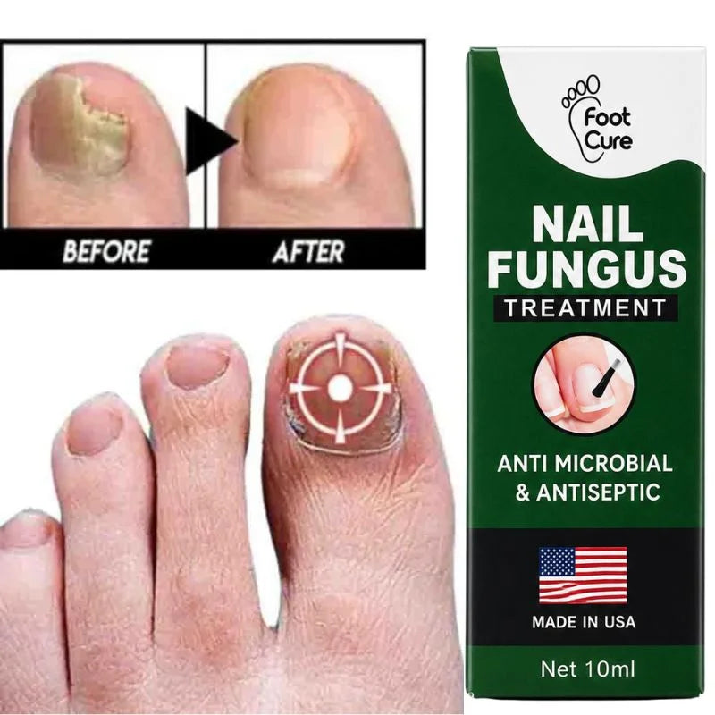 Nail repair essence for dry and brittle-looking nails