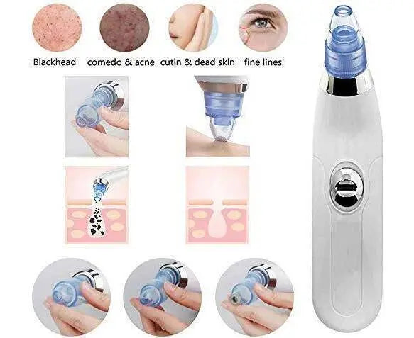 Hunt PK derma suction device shown addressing different skin concerns