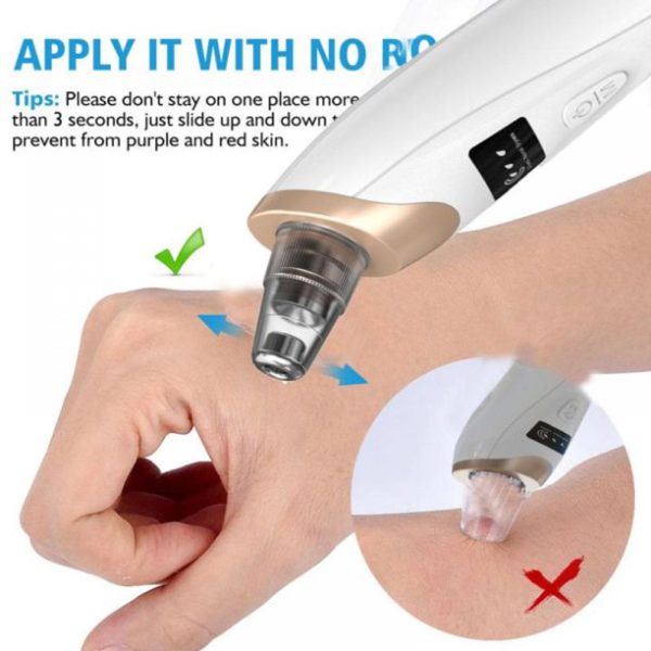 Blackhead Removal Machine |  5 in 1