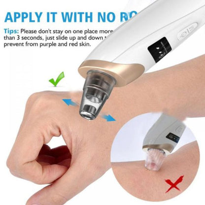 Blackhead Removal Machine |  5 in 1